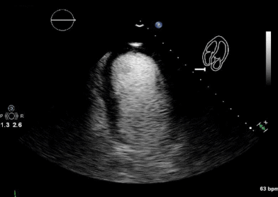 NEW: 66-year-old male with hypertension